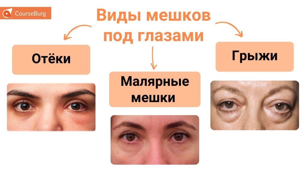 Народные рецепты: как убрать мешки под глазами и отеки век